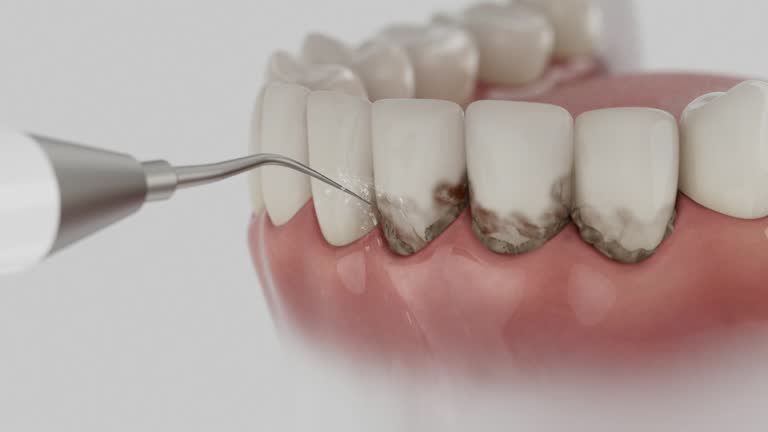 Trusted Dental Implants service in Maple Heights, OH - Dentist Open Now